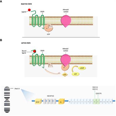 Brain and eye involvement in McCune-Albright Syndrome: clinical and translational insights